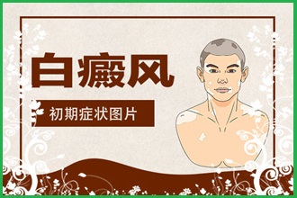 白癩風遮蓋液去哪家買好，什么牌子的比較好用呢